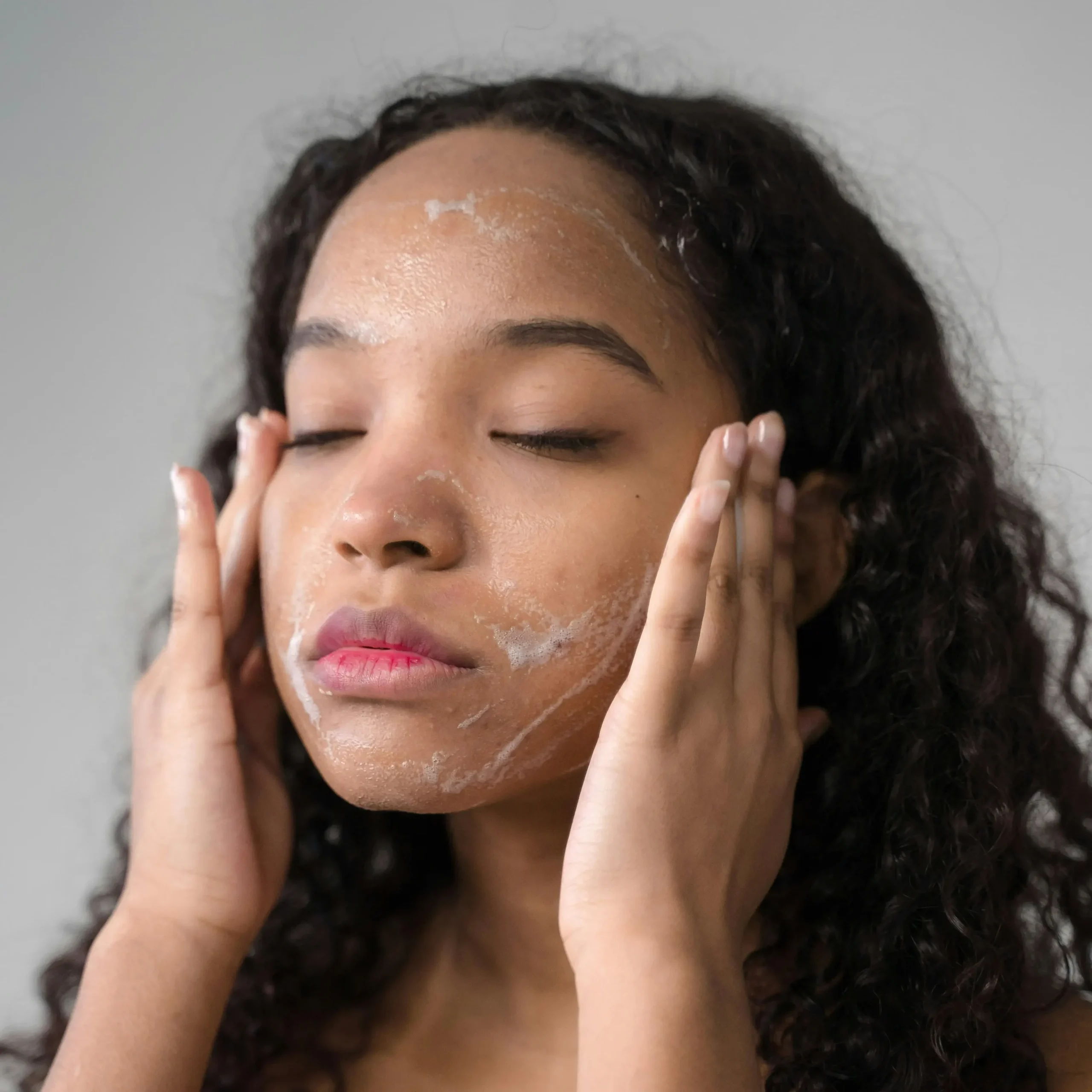 Chica adolescente usando una crema hidratante para la piel acneica.