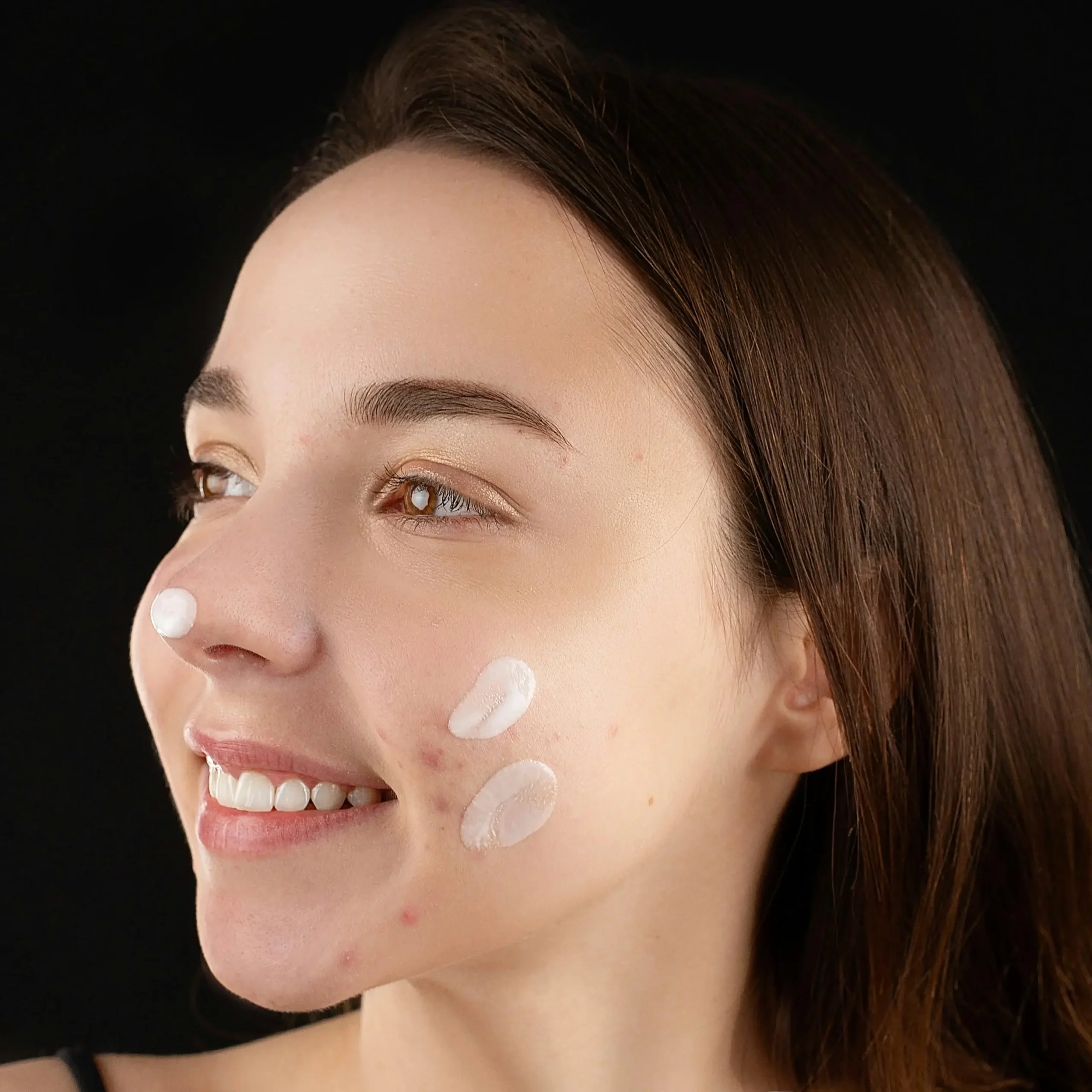 Chica adolescente aplicando una crema buena para quitar el acné juvenil.