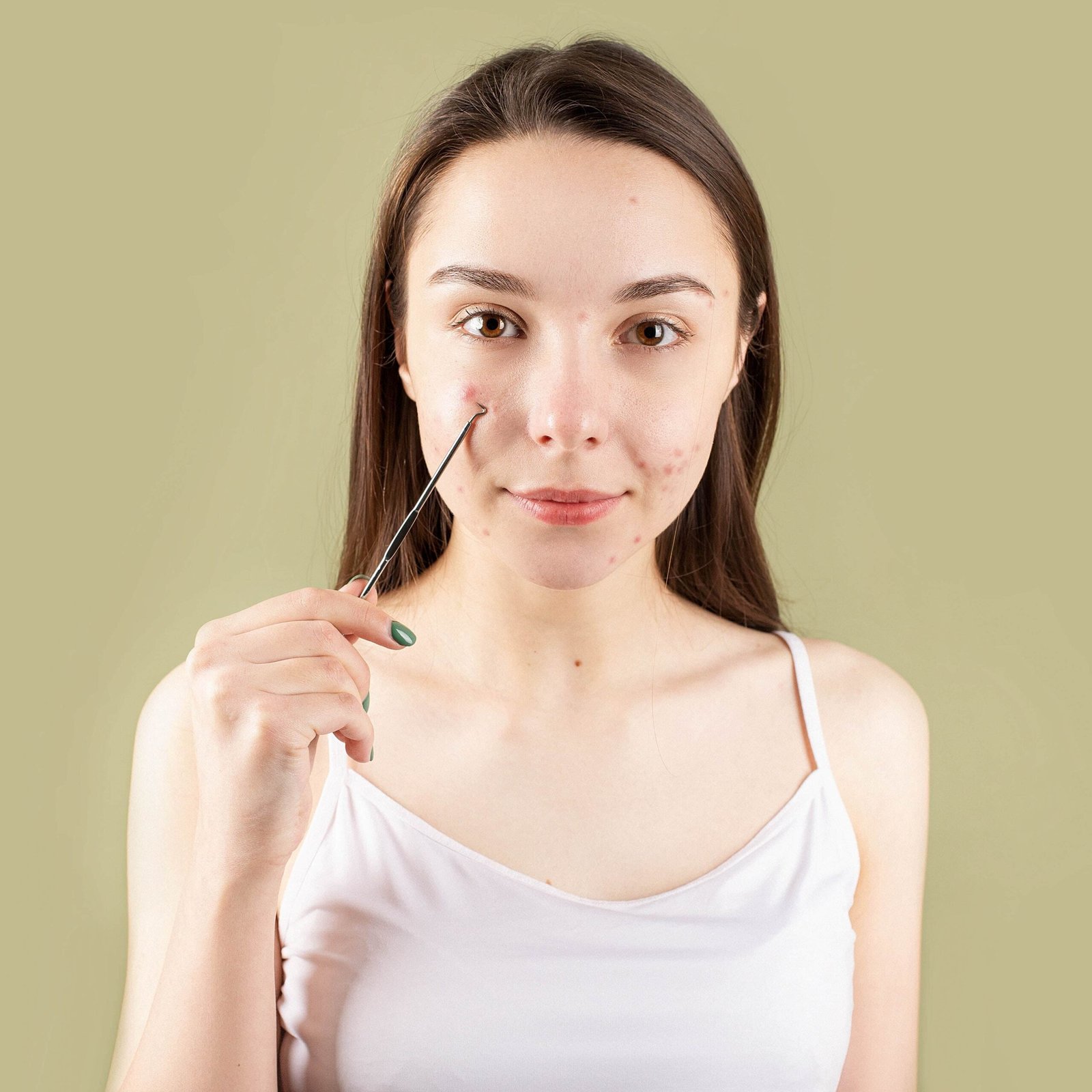 Productos anti espinillas, granos e imperfecciones.
