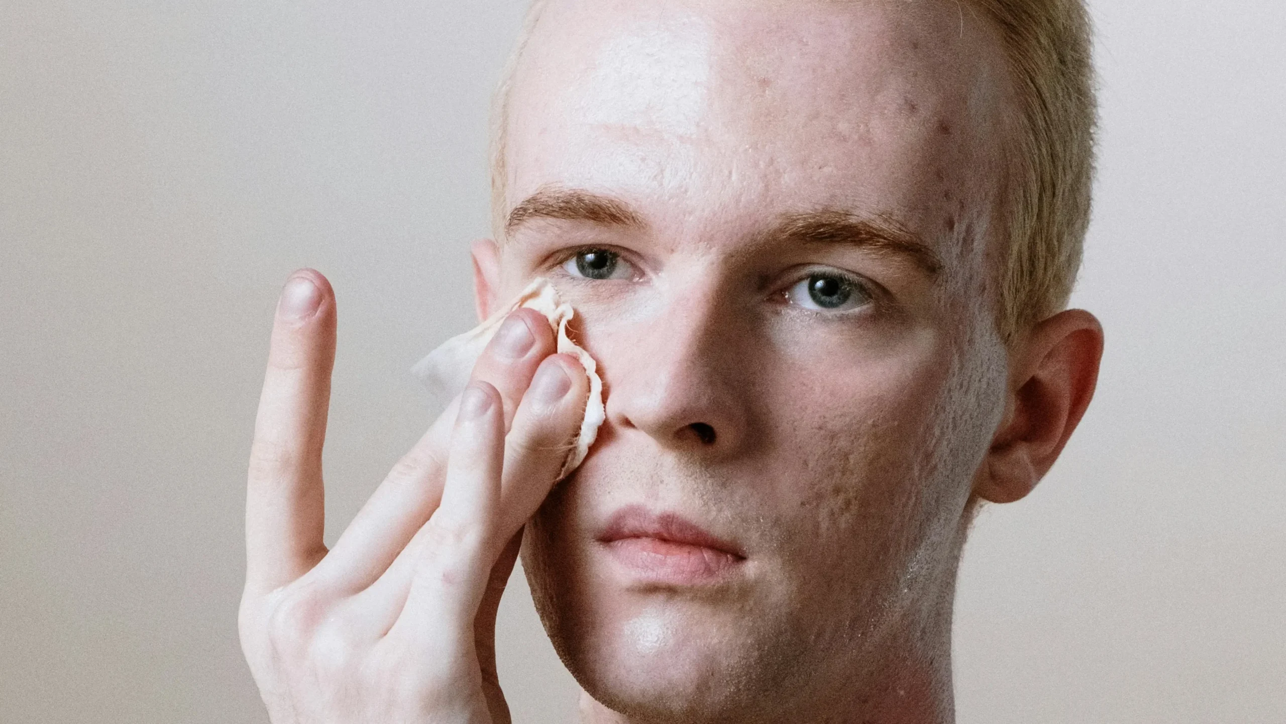 Adolescente aplicando una rutina de skincare para la piel acneica grasa.