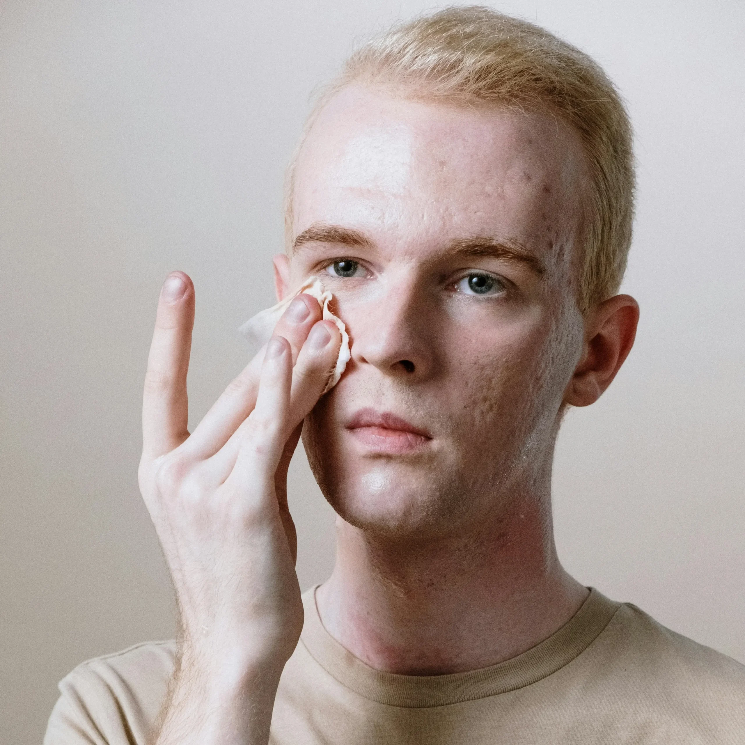 Joven aplicando una rutina fa facial para quitar marcas y cicatrices del acné.