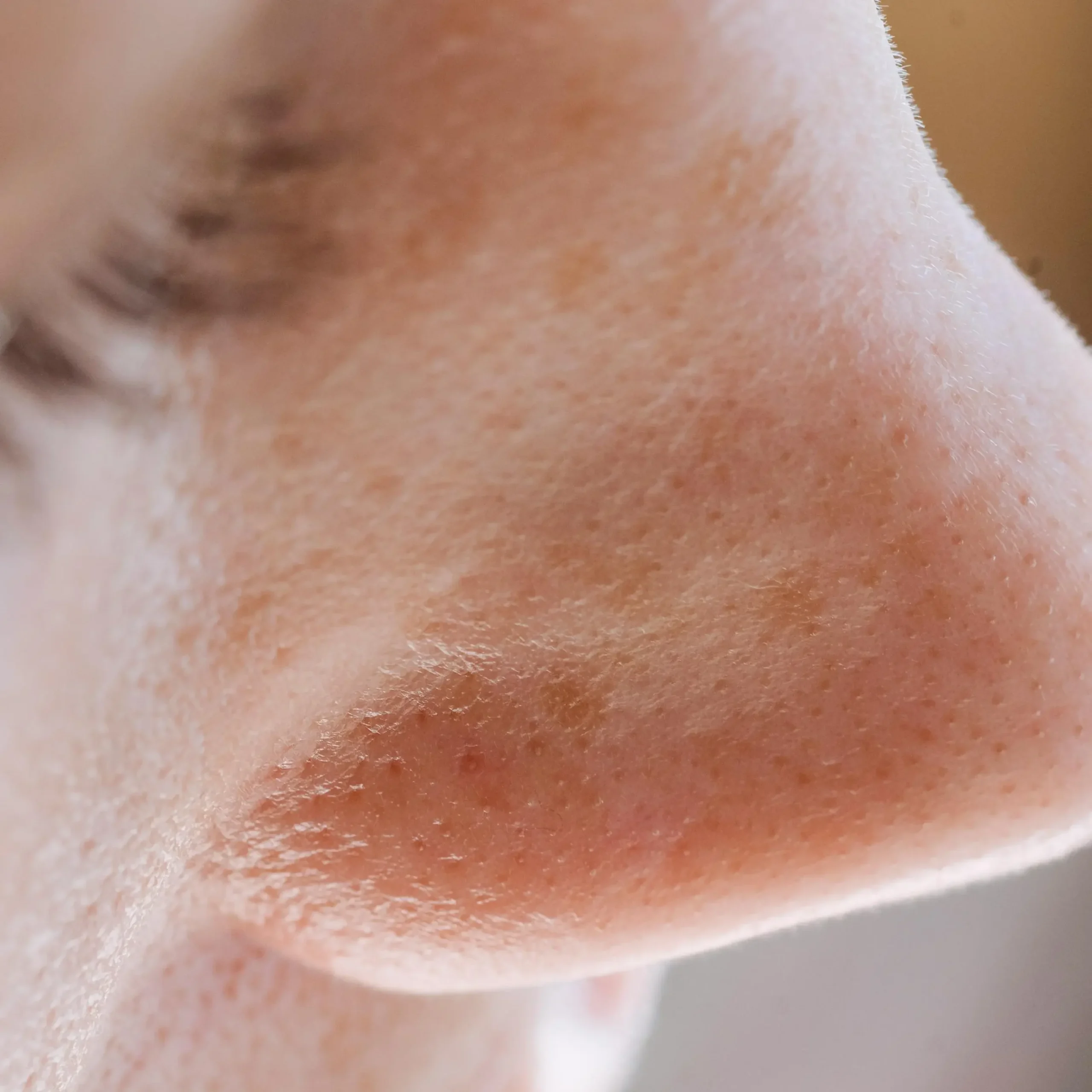 Reduce imperfecciones y puntos negros.